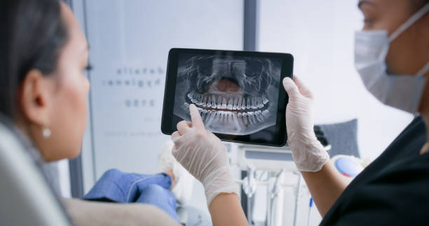 Licensed Dental Implants service in Bluffton, IN - Smile Center Dentistry
